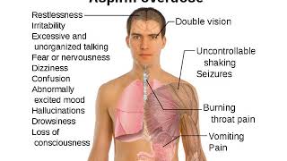 Nonsteroidal Anti inflammatory drugs NSAIDSPharmaceutical Biotechnology [upl. by Pigeon]