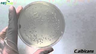 SDSabouraud Dextrose Agar [upl. by Gannie926]