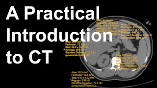 A Practical Introduction to CT [upl. by Petulah]