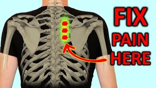 quotRhomboid Painquot How To Fix Shoulder Blade Pain Quickly [upl. by Nahsez]