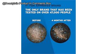 Mens Rogaine 5 Minoxidil Foam Review Is It the Solution for Hair Regrowth You Need [upl. by Ateekal653]