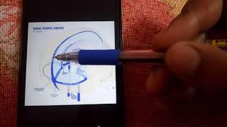 DURAL VENOUS SINUSES simplest explanation part 2 [upl. by Gruchot]