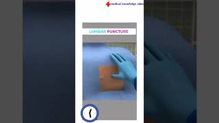 Lumbar Puncture Procedure [upl. by Tarah]