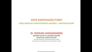 VATS ESOPHAGECTOMY FOR ESOPHAGEAL CANCER [upl. by Retrak]