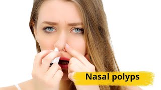 Nasal polyps Causes symptoms and treatments [upl. by Case]