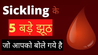 sickling के 5 बड़े झूठ जो आपको बोले गये हैSickle cell Anemia [upl. by Atiuqiram876]