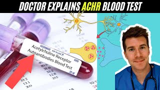 Doctor explains Acetylcholine Receptor Autoantibody blood test AChR Ab  Myesthenia Gravis [upl. by Sheba762]