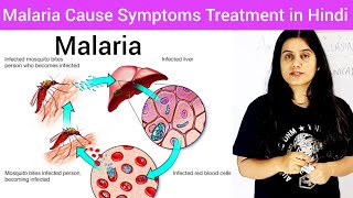 Malaria Cause Symptoms Diagnosis Treatment Hindi  Life Cycle of Plasmodium Hindi  What is Malaria [upl. by Araec]