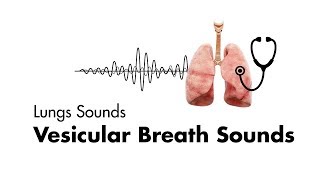 Vesicular Breath Sounds  Normal Lung Sounds  MEDZCOOL [upl. by Aneled]