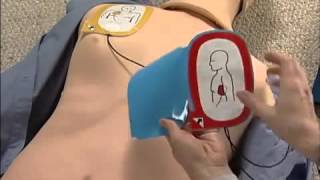 Physio Control LifePak CR Plus Demo [upl. by Yadsnil990]