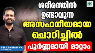 ശരീരത്തിൽ ഉണ്ടാവുന്ന അസഹനീയമായ ചൊറിച്ചിൽ ഇനി പൂർണ്ണമായും മാറ്റം  Chorichil Maran Malayalam [upl. by Felty764]