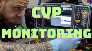 How to perform CVP monitoring Zero it Square Fast Flush Test to check Transducer system damping [upl. by Nowaj345]