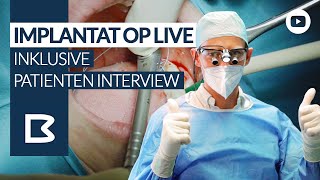 Zahnimplantat einsetzen OP LIVE  inkl Patienten INTERVIEW [upl. by Mohun133]