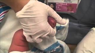 Newborn screening for PKU [upl. by Irb848]