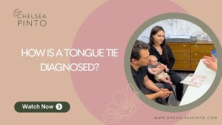 How is a Tongue Tie Diagnosed [upl. by Arodaeht]