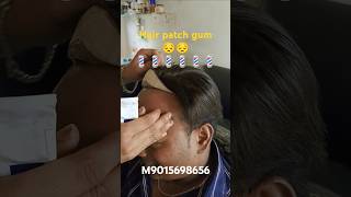 new video hair patch gum service 💯💯💯💯 [upl. by Copp174]