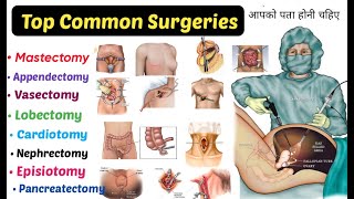 Top 15 Common Surgeries  You Should Know  mastectomy Appendectomy Lobectomyamp More [upl. by Ehc463]