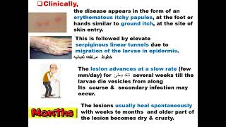 Parasitology ASU GIT Ancylostoma caninum amp Toxocara Dr Khaled Habib [upl. by Lemrac249]