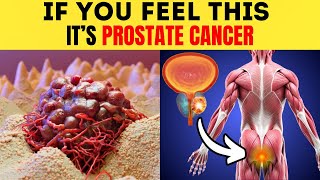 Prostate Cancer 10 Early Signs and Symptoms Don’t Ignore [upl. by Cerelly]