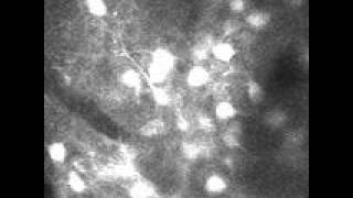 Firing Neurons in Mouse Visual Cortex [upl. by Olegnaed]