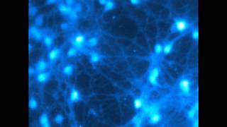 Calcium imaging in cerebellar neurons [upl. by Eelyrehc978]