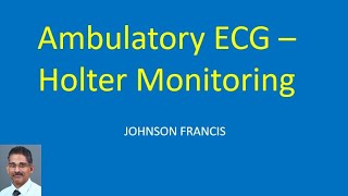 Ambulatory ECG – Holter Monitoring [upl. by Natye]