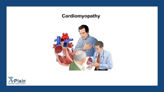 Cardiomyopathy [upl. by Ruckman29]