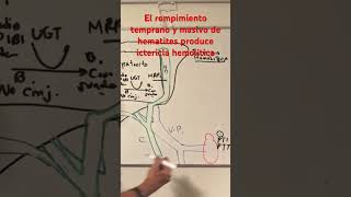 Ictericia hemolitica por ruptura de hematies PTI PTT uremia [upl. by Yssac]