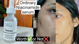 The Ordinary Niacinamide serum Review  Truth about Ordinary NiacinamideTrying Most Hyped Skincare [upl. by Delanos208]