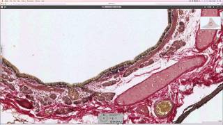 Histology of the lung [upl. by Egamlat]