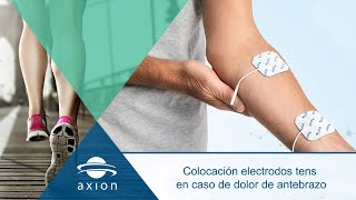 Colocación electrodos TENS para dolor de antebrazo  Electroestimulación TENS para terapia del dolor [upl. by Chil]