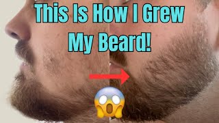 This Is How I Grew My Beard With Minoxidil And a Derma Stamp [upl. by Gregoire266]