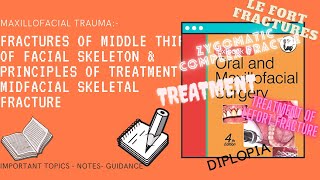 FRACTURES OF MIDDLE THIRD OF FACIAL SKELETON  PRINCIPLES OF TREATMENT  LEFORT FRACTURE [upl. by Asus863]