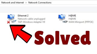 Network cable unplugged error in Windows 10  11 Fix [upl. by Messere]