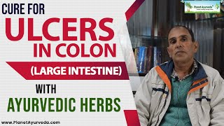 Cure for Ulcers in Colon Large Intestine with Ayurvedic Herbs [upl. by Shotton]