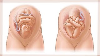 Zoom sur les positions de bébé avant laccocuhement [upl. by Edy]