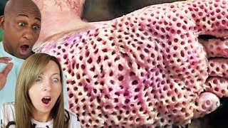 THE FEAR OF HOLES Trypophobia Test Watch If You Dare [upl. by Lezah]