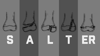 Salter Harris Fracture Classification  MEDZCOOL [upl. by Chessa]