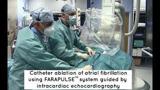 Catheter ablation of atrial fibrillation [upl. by Ringe]