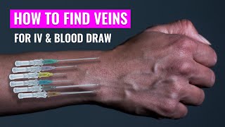 How to find a vein  Nursing phlebotomy  Vein Finder  Finding vein for IV  Christina NP [upl. by Enej]