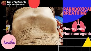 Paradoxical breathing pattern  Diaphragmatic paradox paradoxicalrespiration diaphragmaticpalsy [upl. by Hume]