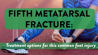 Fifth metatarsal fracture Treatment options for this common foot injury [upl. by Malchus869]