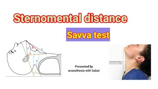 Sternomental distance  SAVVA TEST  SHORT VIDEO anaesthesiawithbabar2576 [upl. by Mihe285]