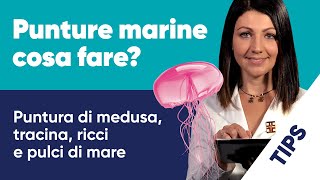 Puntura di medusa tracina ricci e pulci di mare cose da fare e non fare in caso di punture marine [upl. by Thurmann771]