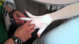 Arm Lymphedema wrapping [upl. by Repooc918]