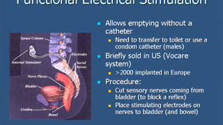 Management of Urinary Problems Caused by Spinal Cord Injury [upl. by Yeta]