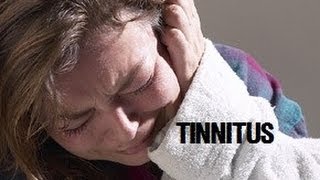 My Tinnitus amp Hearing Loss Struggle Sensorineural Hearing Loss Vlog 1 [upl. by Ettigirb]