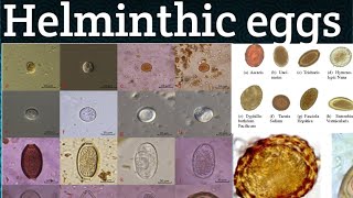 Different ParasiticHelminthic eggs ll Vet Parasitology ll TrematodesCestodesNematodesVetjunction [upl. by Mya1]