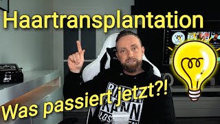 Haartransplantation  Was passiert jetzt [upl. by Anomer]