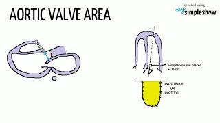 CONTINUITY EQUATION IN ECHOCARDIOGRAPHYHEART AND TECHY [upl. by Jerrylee]